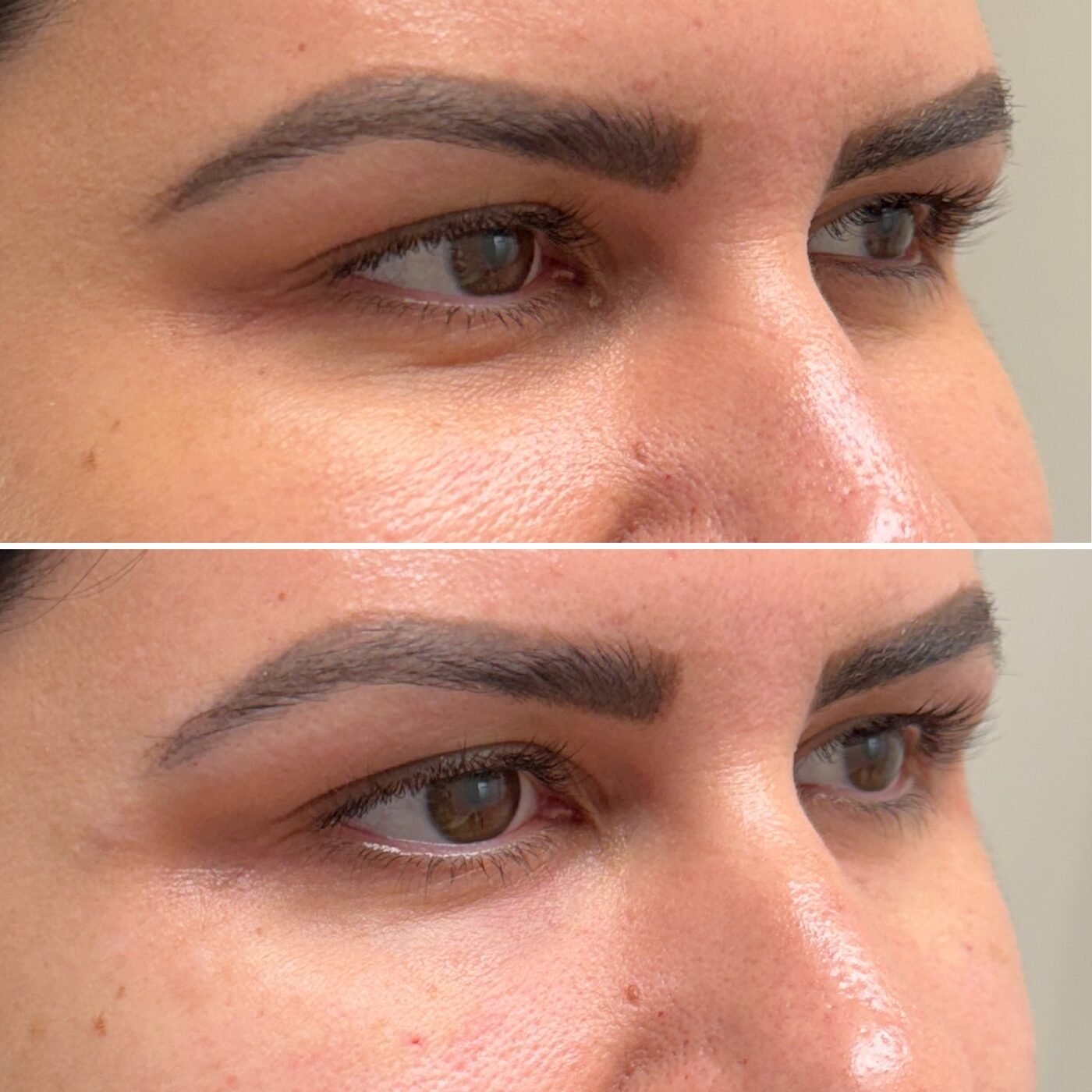 Under-Eye before and after — TAI Longevity