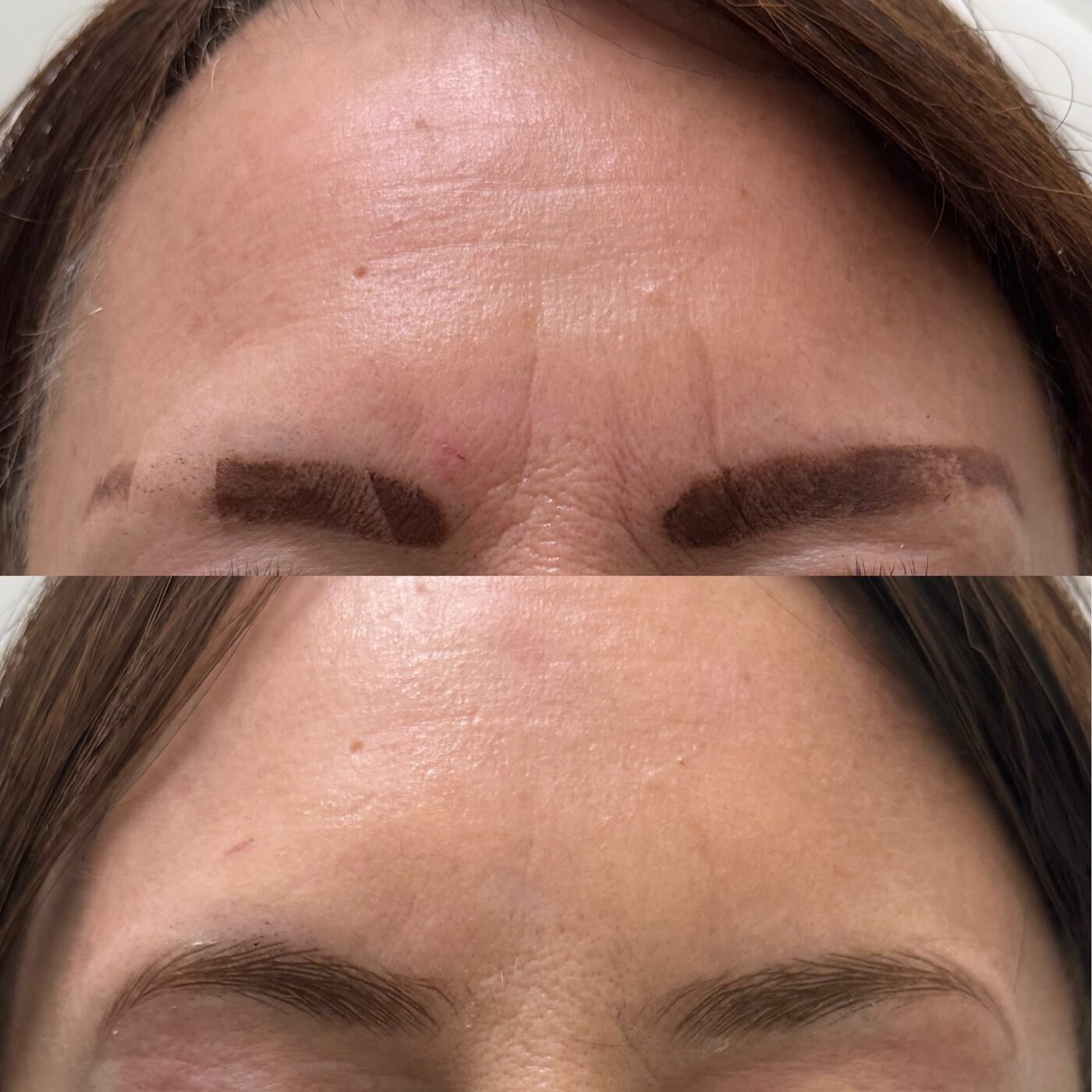 Wrinkle Relaxer before and after — TAI Longevity