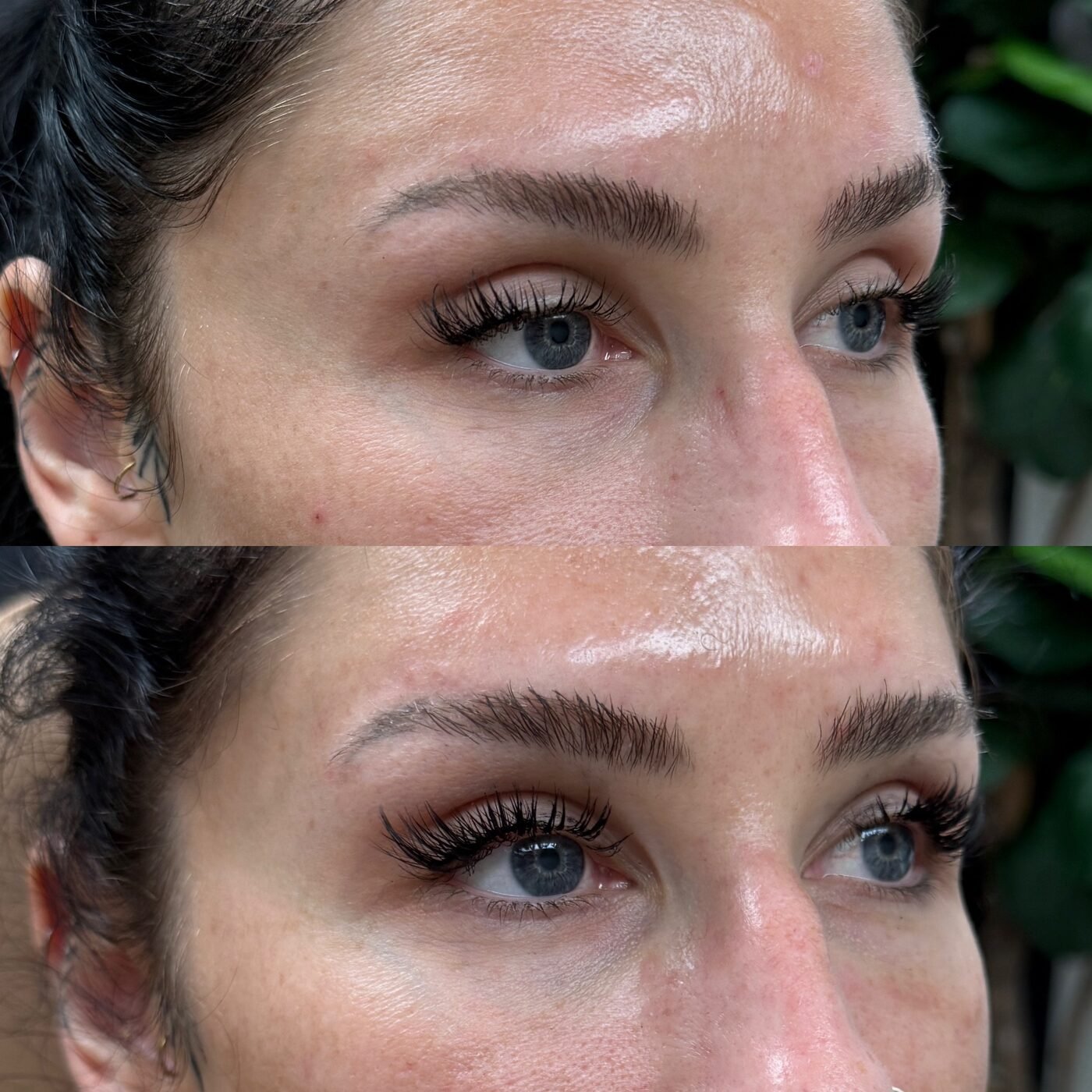 Under-Eye before and after — TAI Longevity