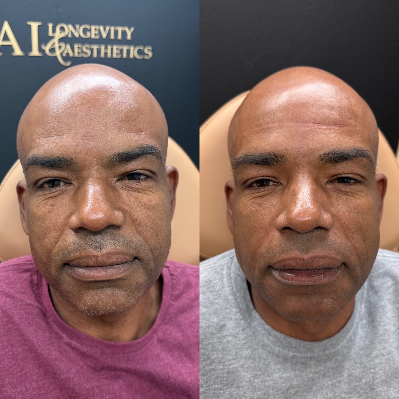 Skin & Texture before and after — TAI Longevity